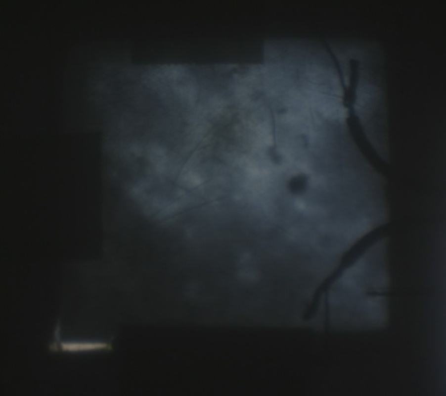 Projected image of LC pixel in the dark/opaque state (voltage applied), showing the same square now mostly dark